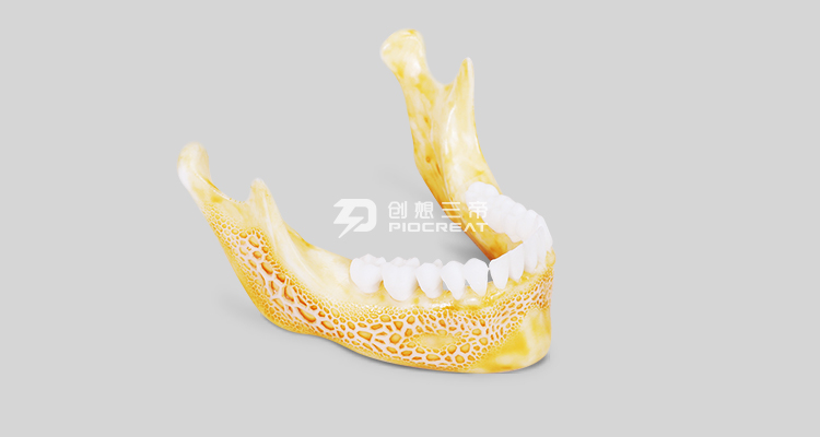 齿科3D打印机在口腔领域利用的优势